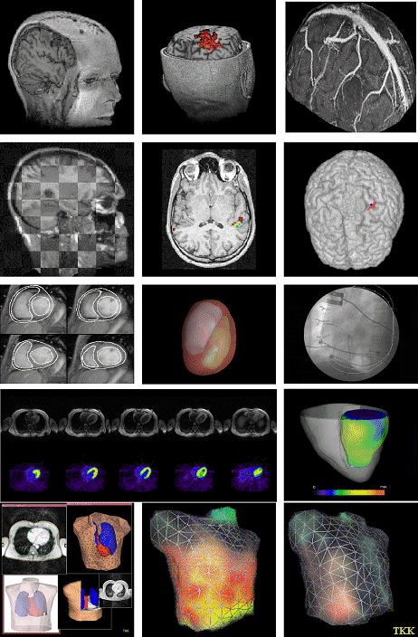 brain-image1